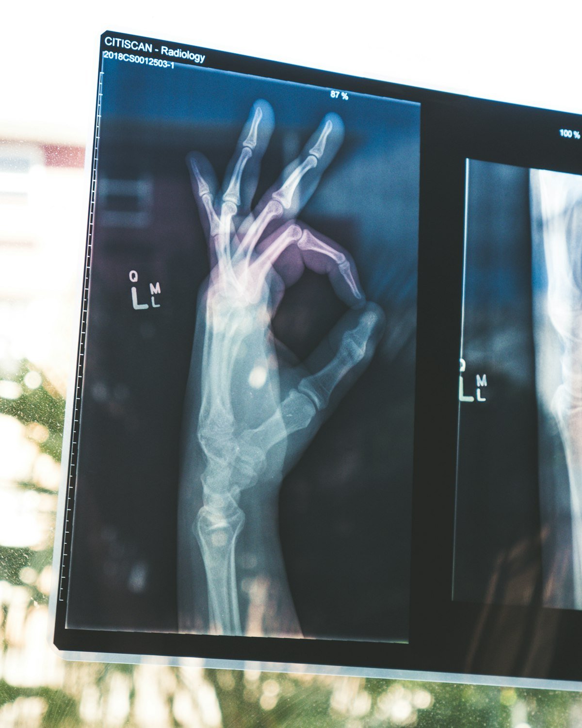 Orthopaedics Clinic Software India — Manage Bones, Joints & Physiotherapy